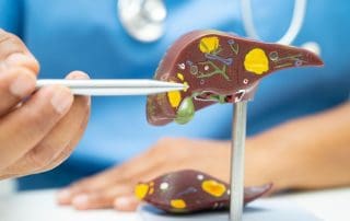 Cholangiocarcinoma Foundation Australia