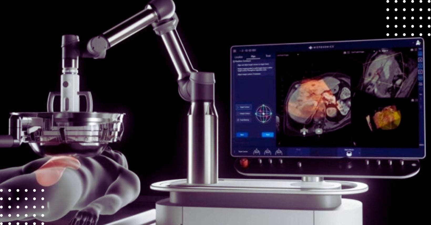 Cholangiocarcinoma Foundation Australia Pioneering Cancer Intervention