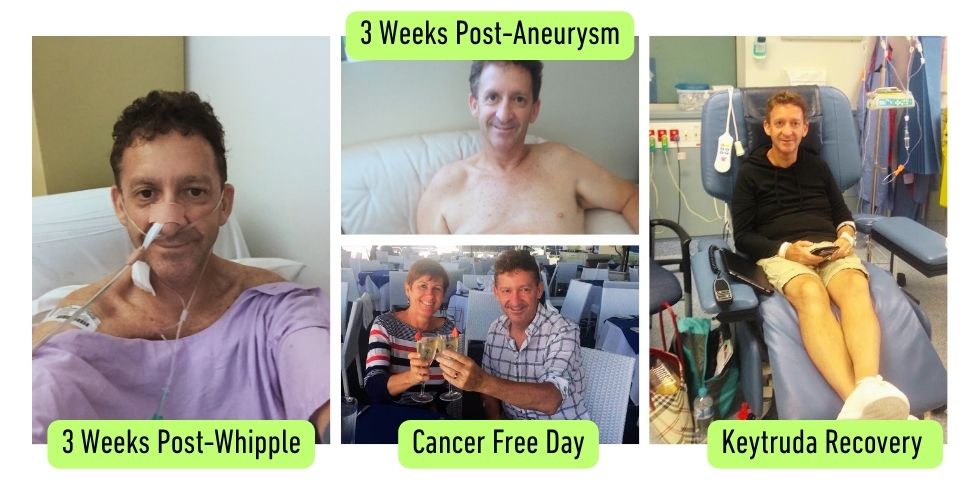 Stage 4 cholangiocarcinoma survivor Steve Holmes shares his bile duct cancer story, Keytruda complete response, and why the Foundation began. 